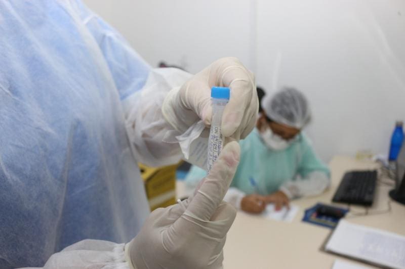 Centro de Testagem do CIS terá horário de atendimento ampliado em Itajaí
