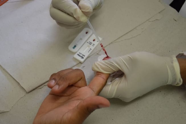 Saúde orienta farmácias sobre testes para HIV, sífilis e hepatites