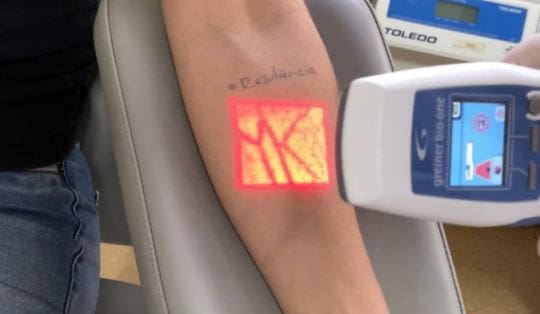 Tecnologia: Hemosc adquire scanner para visualização de veias
