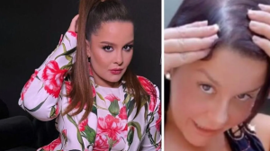 Maiara revela que sofre com queda de cabelo e passa por tratamento