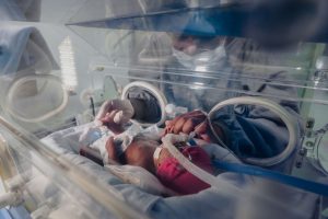 Bebê prematura nascida com menos de meio quilo recebe tratamento em SC