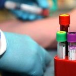 Hospital oferece exame que detecta mais de 50 tipos de câncer