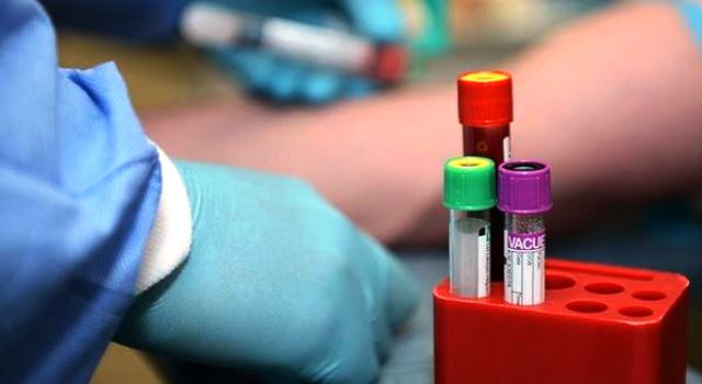Hospital oferece exame que detecta mais de 50 tipos de câncer