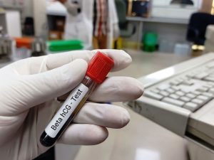 Beta hCG: o exame que confirma que tem bebê vindo por aí