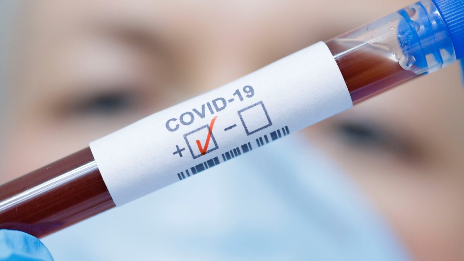 Brusque registra aumento nos casos de Covid-19; quase 500 em 2024