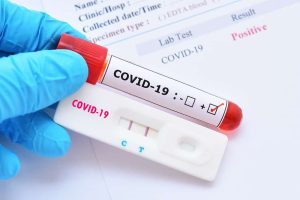 Brusque registra primeira morte por Covid-19 em 2024