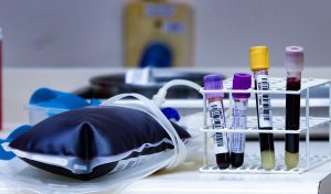 Dezembro Vermelho: Saúde reforça a prevenção contra HIV e Aids