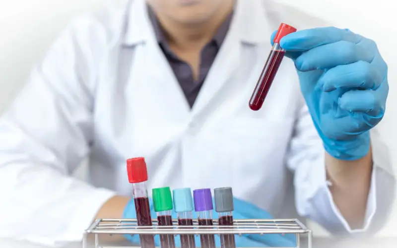 Exame de sangue busca sinais de mais de 50 tipos de câncer
