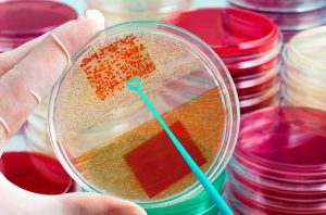 Criança de 4 anos é diagnosticada com meningite bacteriana