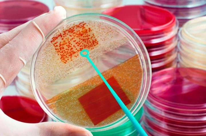 Criança de 4 anos é diagnosticada com meningite bacteriana