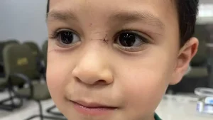 Criança é ferida por linha de cerol em Balneário Camboriú
