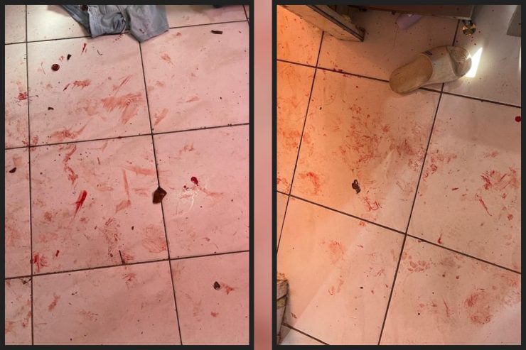 Briga de casal termina com esposa presa e marido gravemente ferido