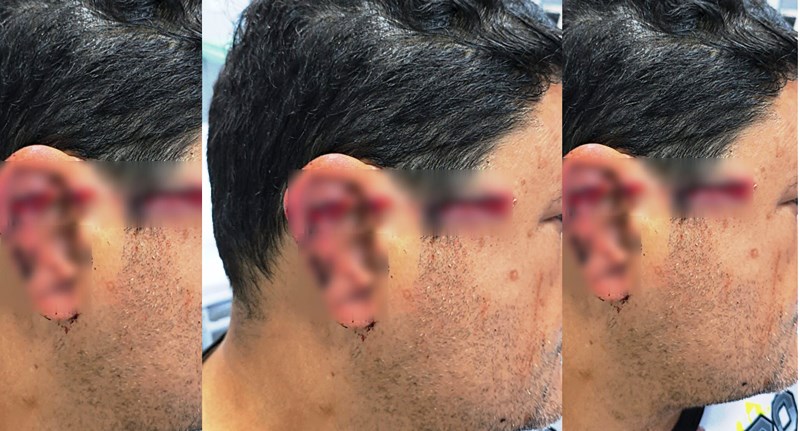 Empresário reage a assalto, leva tiro e mata ladrão em SC