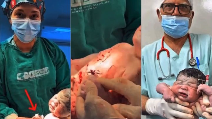 Vídeo de recém-nascido com DIU na mão viraliza: “Adiuson ou Diusinho”