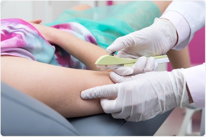 MS libera contraceptivo para adolescentes sem autorização dos pais