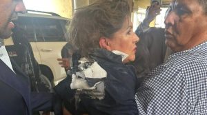 Explosivo atinge deputada durante entrevista em Congresso Nacional