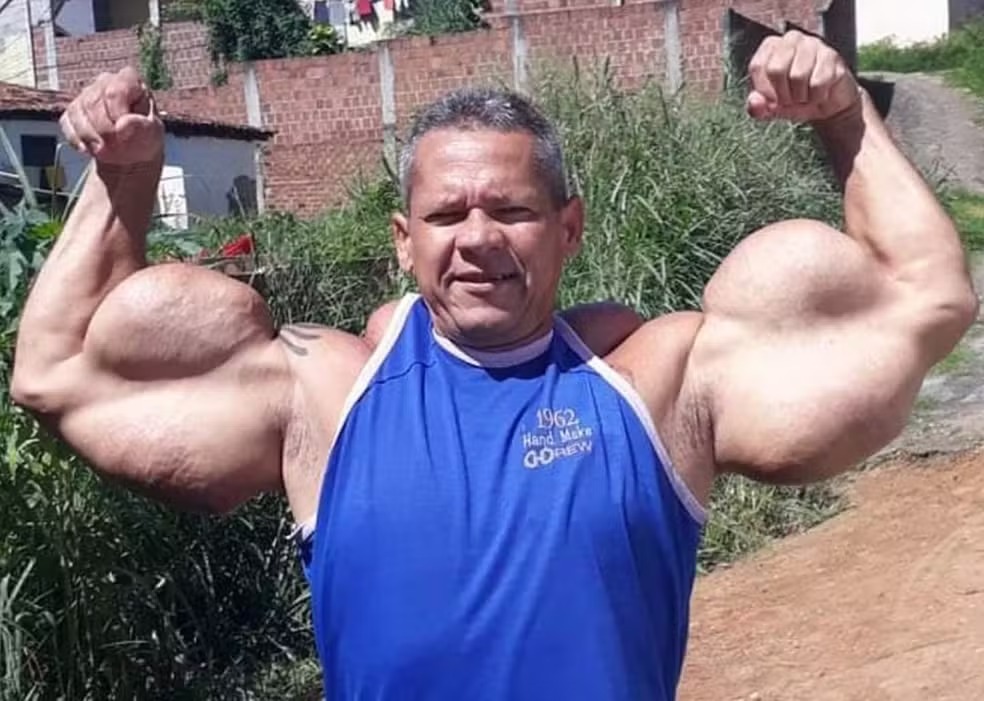 Popeye Brasileiro morre no Recife aos 55 anos