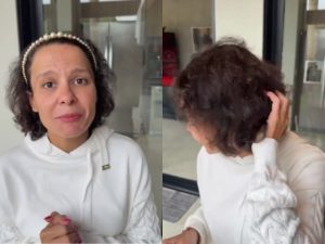 Maiara expõe diagnóstico e reacende debate sobre queda de cabelo