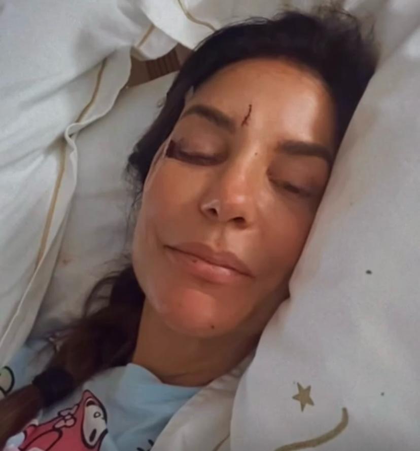 Vídeo: Ivete Sangalo cai, é internada e se pronuncia para os fãs