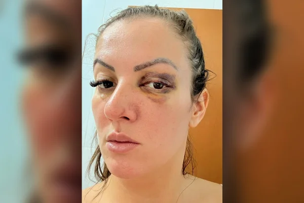 Vídeo: Após agressão, vereadora atropela namorado