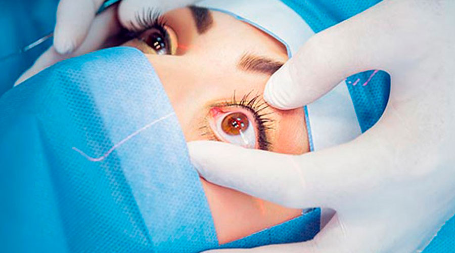 Cirurgia a laser corrige visão e reduz uso de óculos