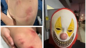 Adolescente é atacado por homem mascarado de palhaço