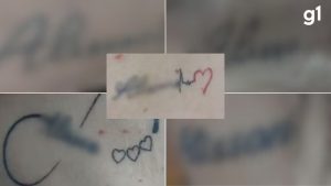 Dentista é preso por cárcere, agressões e tatuagens forçadas contra companheira