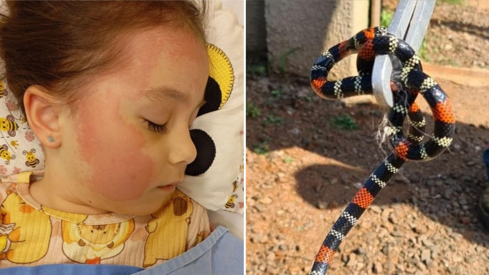 Criança confunde cobra-coral com minhoca e sofre picada em Itajaí