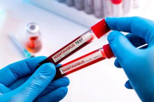 Hantavírus: especialistas descartam risco de pandemia
