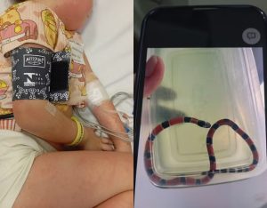 Menina sofre choque anafilático após irmão confundir cobra com minhoca