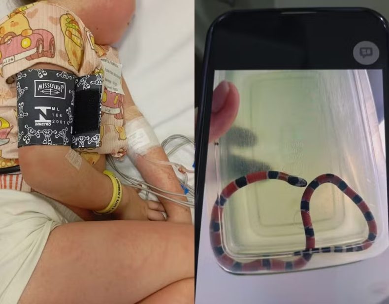 Menina sofre choque anafilático após irmão confundir cobra com minhoca