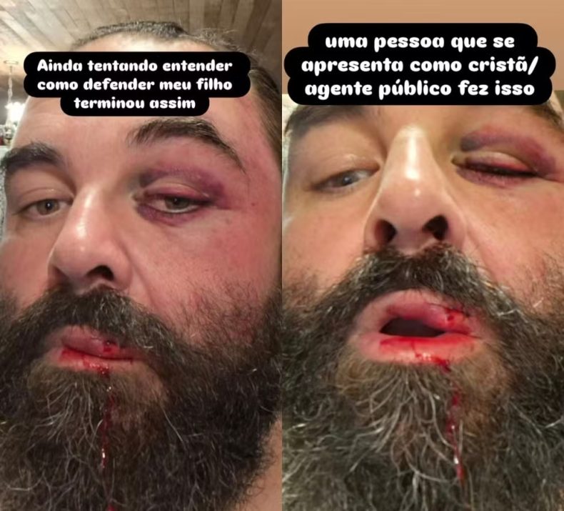 Morador é atacado por guarda municipal ao reclamar de som alto em igreja