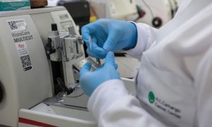 SUS ganha novo tratamento contra câncer no sangue