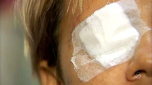 Mulher que perdeu a visão após cirurgia no nariz será indenizada em R$ 50 mil