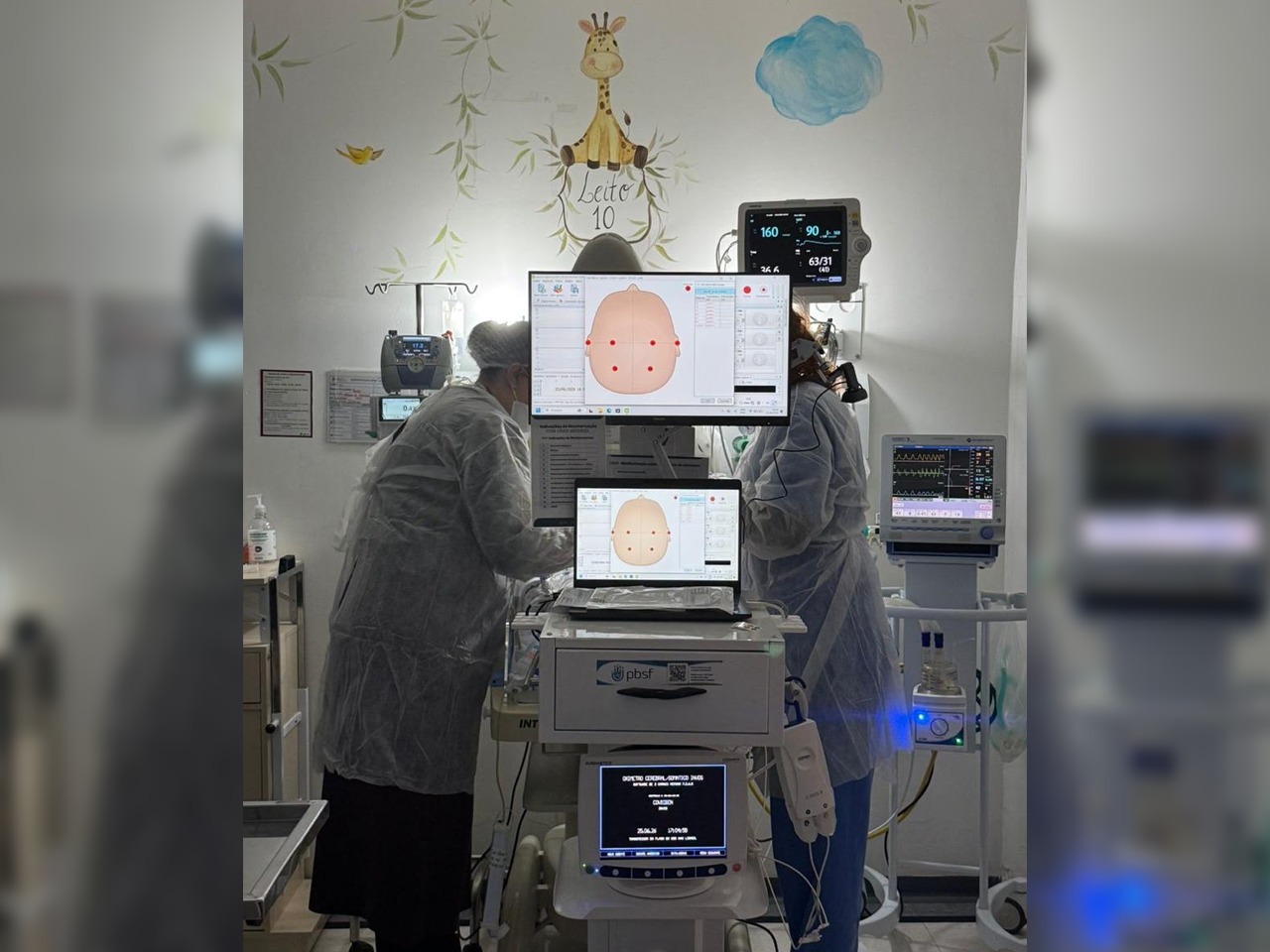 Hospital Jaraguá é pioneiro em SC com monitoramento cerebral de recém-nascidos